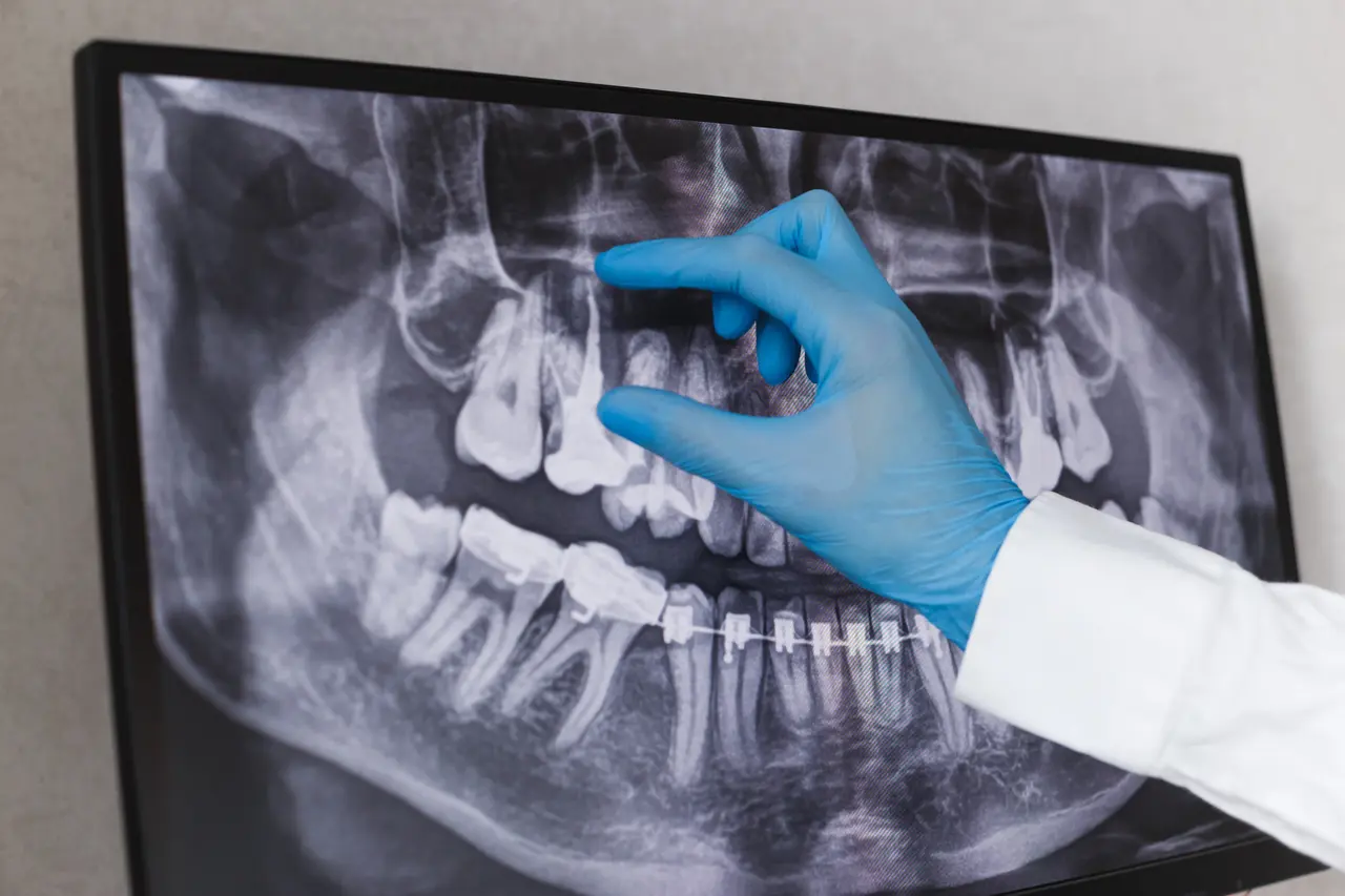 Digital X-rays for safer, faster imaging